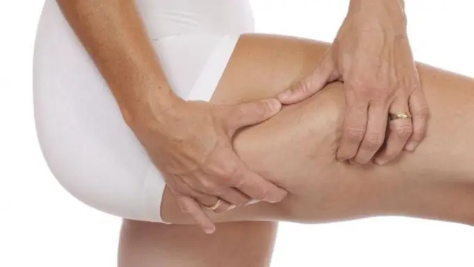 Kabar Bahagia, Ternyata Bahan Dapur Bisa Menghilangkan Selulit