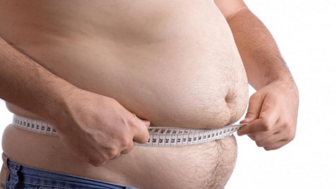 Obesitas