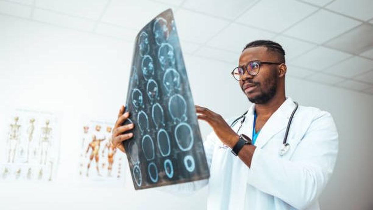 Tapi, apa sebenarnya penyakit Empty Sella Syndrome ini? Apakah penyakit ini berbahaya?<br>