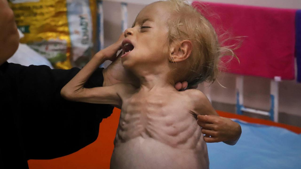 FOTO: Dari Gaza ke Italia, Perjuangan Kecil Shamm Qudeih
