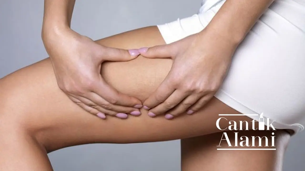 Cantik Alami: Cara Menghilangkan Selulit dengan Bahan Dapur