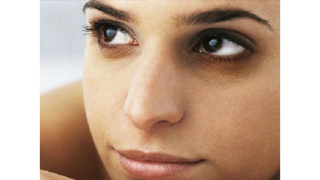 Apa Penyebab Lingkaran Hitam di Bawah Mata?