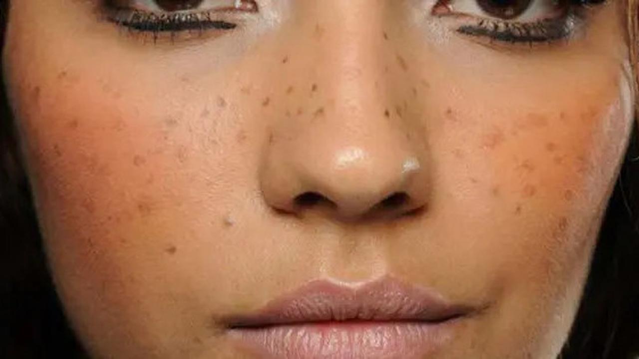 Cara Membuat Masker untuk Regenerasi Kulit Wajah, Solusi Alami untuk Mengatasi Flek Hitam pada Kulit