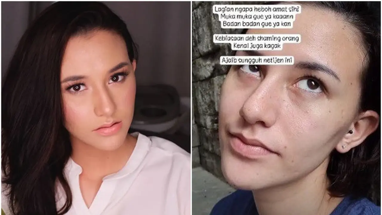 Wajahnya Dicibir Banyak Komedo, Ini 6 Potret Dahlia Poland Tanpa Makeup