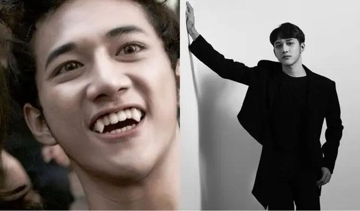 4.&nbsp;Dicky SMASH