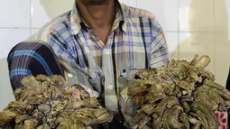 Abul Bajandar (26) menunjukkan tangannya yang ditumbuhi kutil berlebih saat dirawat di Dhaka Medical College dan Rumah Sakit, Bangladesh, Minggu (31/1). Kini kedua tangannya sudah tak bisa berfungsi sebagaimana biasanya. (AFP Photo/Munir uz ZAMAN)