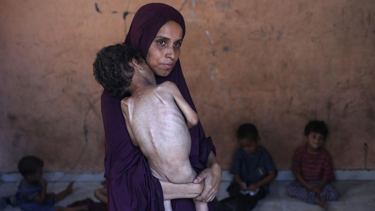 FOTO: Tubuh Kecil yang Lapar, Potret Pedih Bayi Gaza di Tengah Ancaman Kelaparan Massal