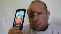 Walter DeLeon menunjukkan foto di SIM-nya di Covina, California, Rabu (2/12/2015). Pria 49 tahun itu kehilangan seperempat tempurung kepalanya setelah ditembak oleh petugas kepolisian Los Angeles pada 19 Juni lalu. (AP/Chris Carlson/Dailymail)
