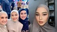 Potret Dara Arafah Dikira Netizen Oplas Dagu dan Filler (Sumber: Instagram/shireensungkar, daraarafah)