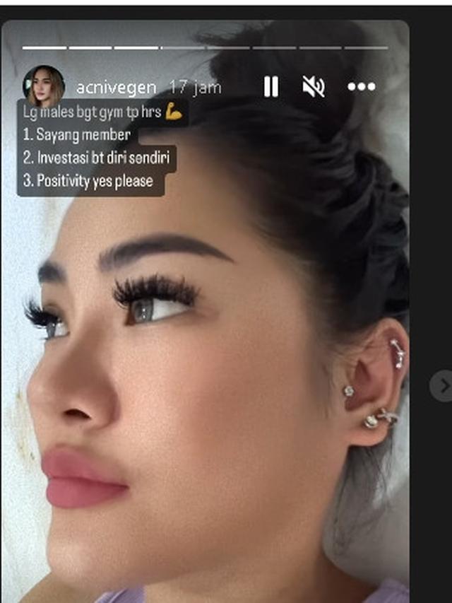 Vegen Acni mantan istri Vincent Raditya yang pertama (Foto Instagram @acnivegen)