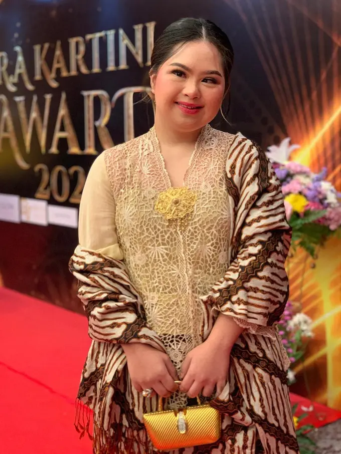 Fimela Figure: Cerita Spesial Namira Zania, Gadis Down Syndrome yang Jadi Penari hingga Model Profesional