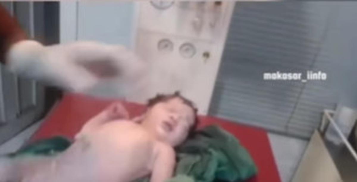 Bayi Baru Lahir Ditampar Berkali-kali oleh Dokter Malah Dipuji Netizen, Ternyata ini yang Terjadi