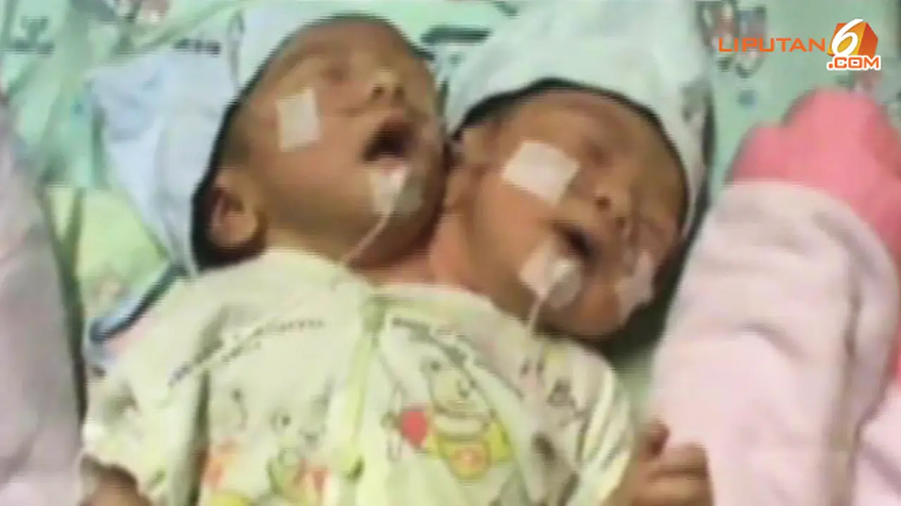 bayi-kepala-dua3-130630-b.jpg
