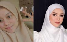 13 Transformasi Artis yang Melakukan Perawatan Dagu Runcing, Sebelum dan Sesudahnya Mengejutkan