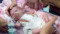 Mengalami kondisi langka, bayi tiga minggu asal Inggris punya jantung yang terletak di luar organ tubuhnya. Source: ITV.com