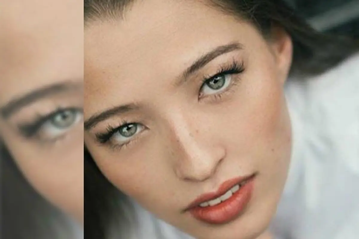 Tragis, Wajah Wanita Cantik Ini Rusak Terkena Pengharum Ruangan