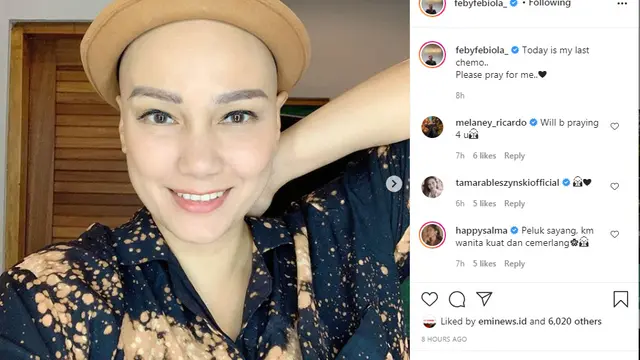Feby Febiola Jalani Kemoterapi Terakhir