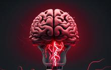 Cara Mengembalikan Ingatan Pasca Stroke, Ketahui Metode Terapinya