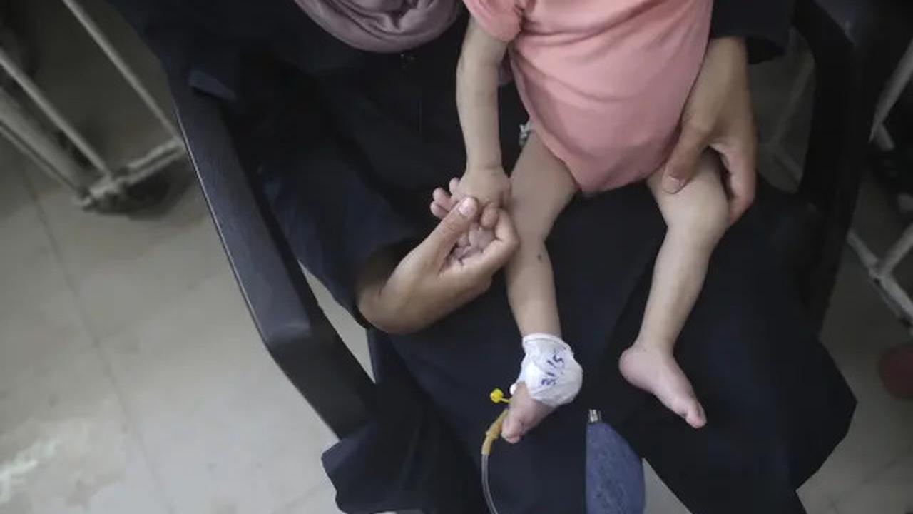 Fakta Anak-anak Gaza Bisa Masuk AS Tuai Kritik, Trump Putuskan Hentikan Visa