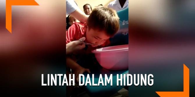 VIDEO: Lintah Hidup Bersarang di Hidung Bocah 7 Tahun