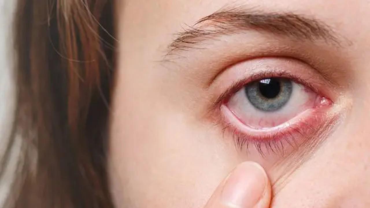 Tanda-Tanda Retinoblastoma pada Anak Sejak Dini