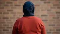Penyakit Langka Bikin Perempuan Ini Tumbuh dengan Tanda-Tanda Maskulinitas