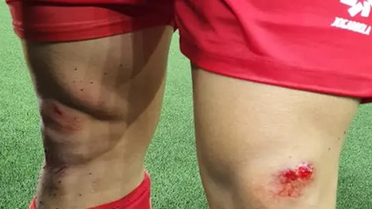 Para Pemain Timnas Vietnam Alami Luka-luka Buntut Main Lawan Filipina di Lapangan Rumput Sintetis