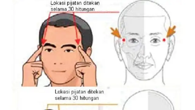 Sakit Kepala