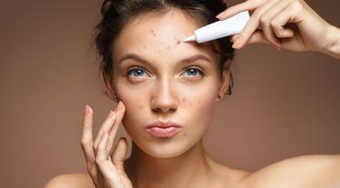 7 Penyebab Jerawat Terasa Gatal Dan Mengganggu Beauty Fimela Com