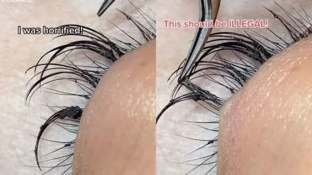 Kisah Wanita Alami Hal Mengerikan Usai Ekstensi Bulu Mata dengan Lem Rambut