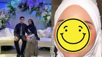 Berkat Makeup, Penampilan Pengantin dengan Luka di Wajah Ini Bikin Pangling