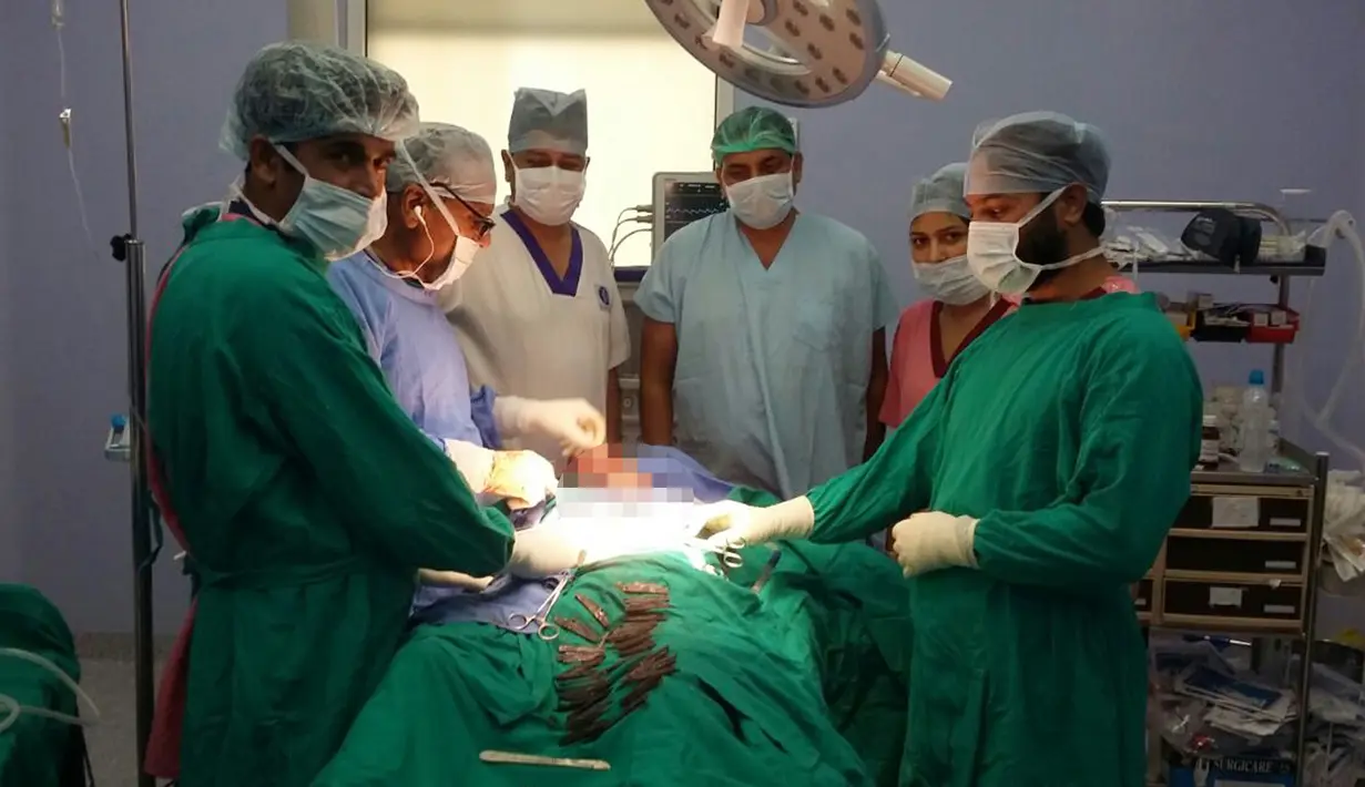 Tim bedah melakukan operasi terhadap seorang polisi India, Surjeet Singh (42) di sebuah rumah sakit di Amritsar, 19 Agustus 2016. Para dokter berusaha mengeluarkan 40 pisau dari dalam tubuh Singh setelah pria itu menelannya selama dua bulan terakhir (AFP)