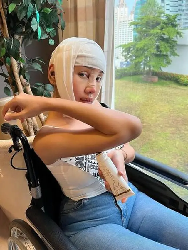 8 Potret Lucinta Luna Kembali Jalani Operasi Plastik, Curi Perhatian