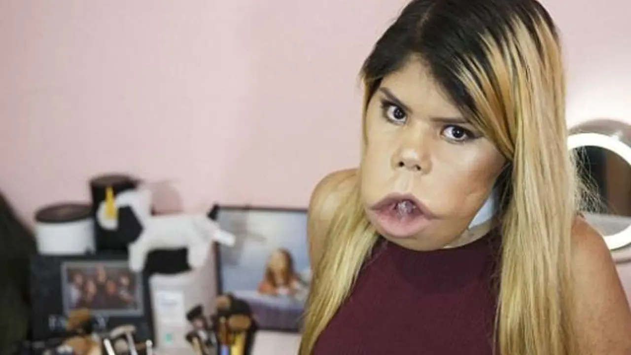 tumor wajah