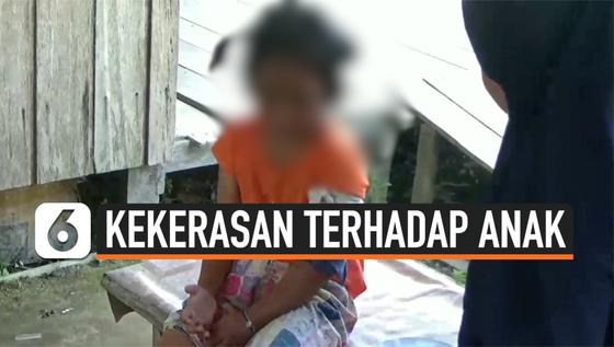 VIDEO: Bocah 6 Tahun Babak Belur dan Patah Tulang Disiksa Ibu Kandung dan Kekasihnya