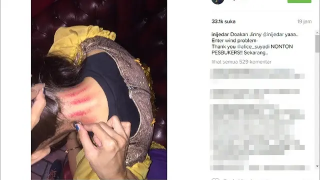 7 Potret Seleb Cantik Pamer Usai Kerokan Ini Tetap Menawan