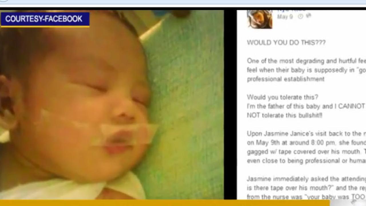 Perawat Solasi Bibir Bayi Baru Lahir karena Menangis Kencang