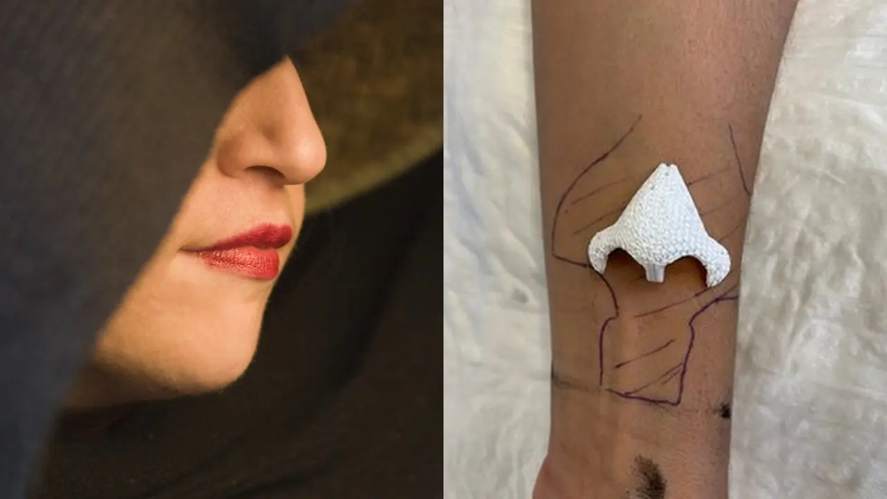 Wanita Punya Hidung diTangan