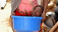 Kisah Pilu Rahma Haruna, Si Gadis dalam Baskom