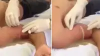 Mengerikan, Otot Binaragawan Ternyata Berisi Minyak