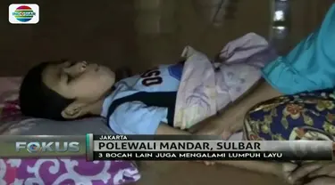 Bocah-bocah bertetangga asal Polewali Mandar, Sulawesi Barat ini mengalami lumpuh layu. Apa penyebabnya?
