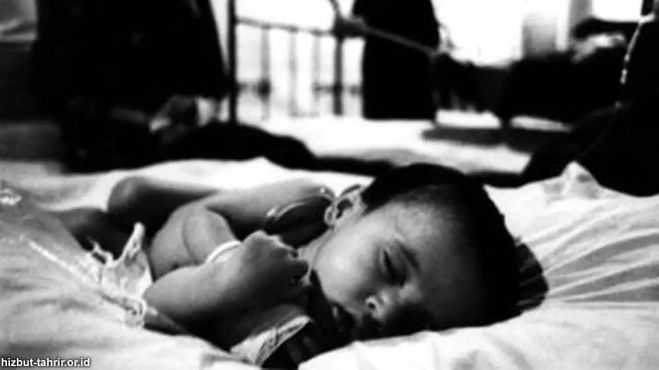 bayi-gizi-buruk-130901b.jpg