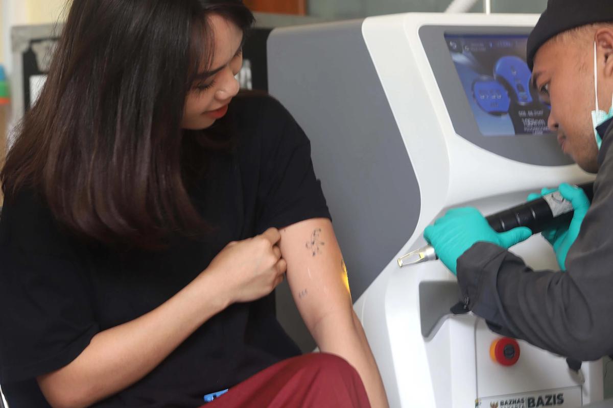FOTO: Layanan Hapus Tato Gratis Sambut Ramadhan di Jakarta