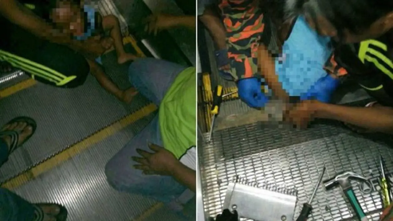 Aduh, Penis Bocah Ini Tersangkut di Ekskalator