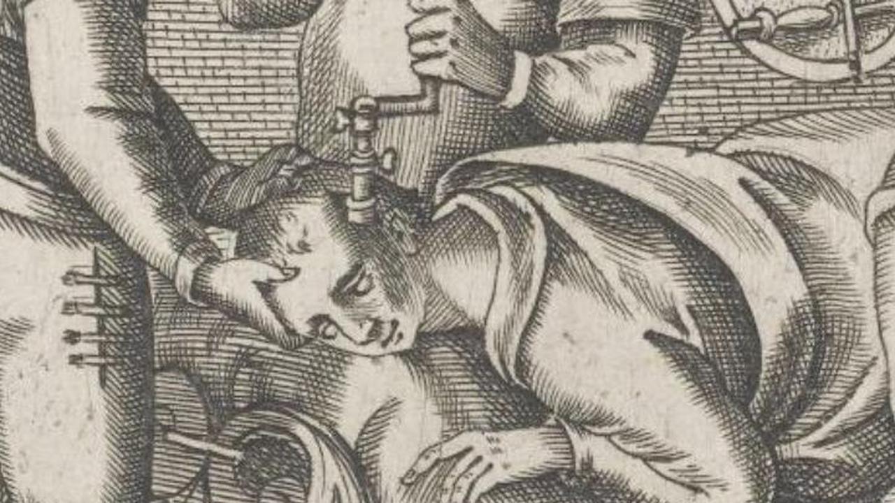 Trepanasi