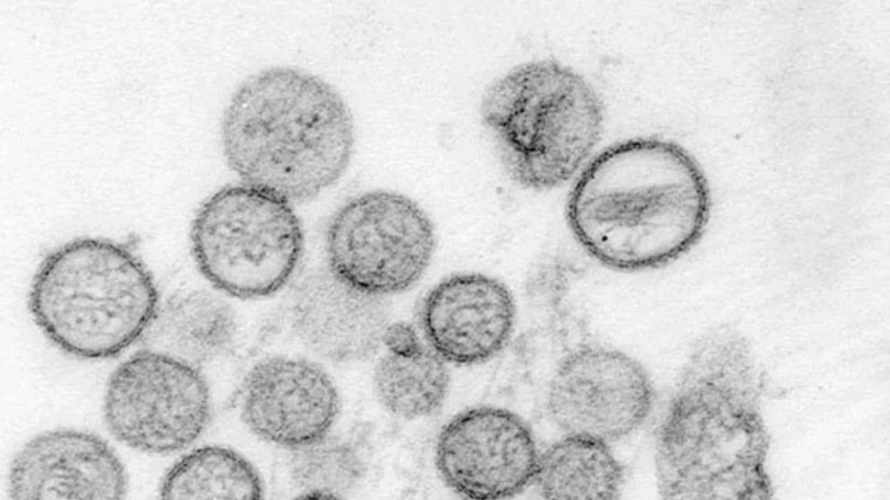 BRIN: Risiko Hantavirus Menjadi Pandemi di Indonesia Rendah, Kewaspadaan Tetap Diperlukan