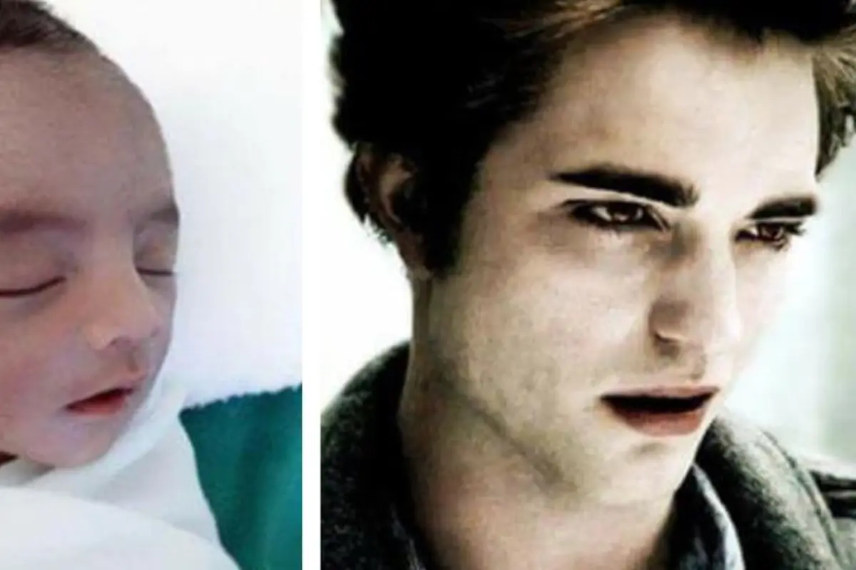[Bintang] Punya Wajah Mirip Robert Pattinson, Bayi Ini Langsung Viral