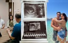 Sedang Mengandung, Jessica Iskandar Urungkan niat Miliki Bayi Kembar, Alasannya Mengejutkan