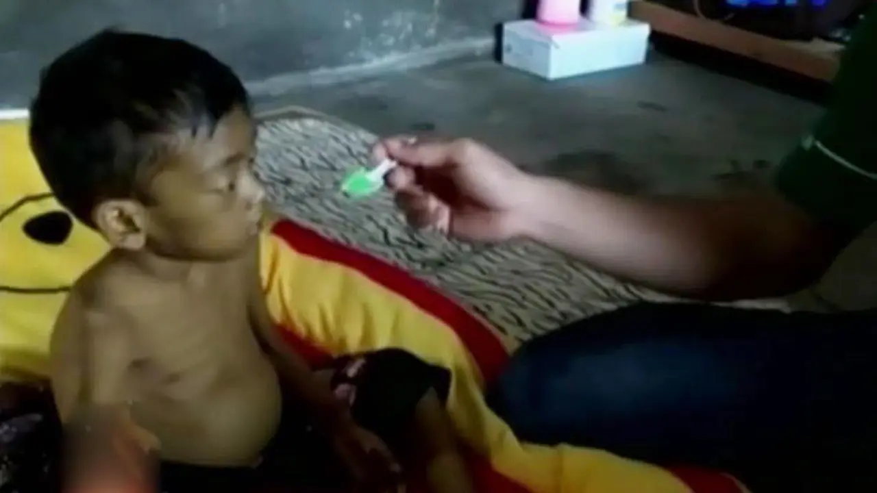 VIDEO: Mahasiswa Galang Dana Pengobatan Bocah Adrian
