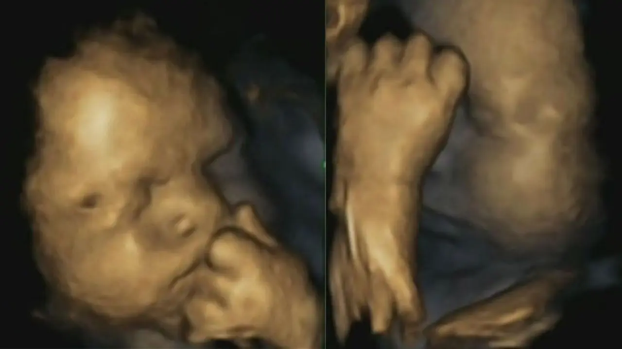 Ibu Hamil Stres, Bayi di Kandungan jadi Sering Sentuh Wajah